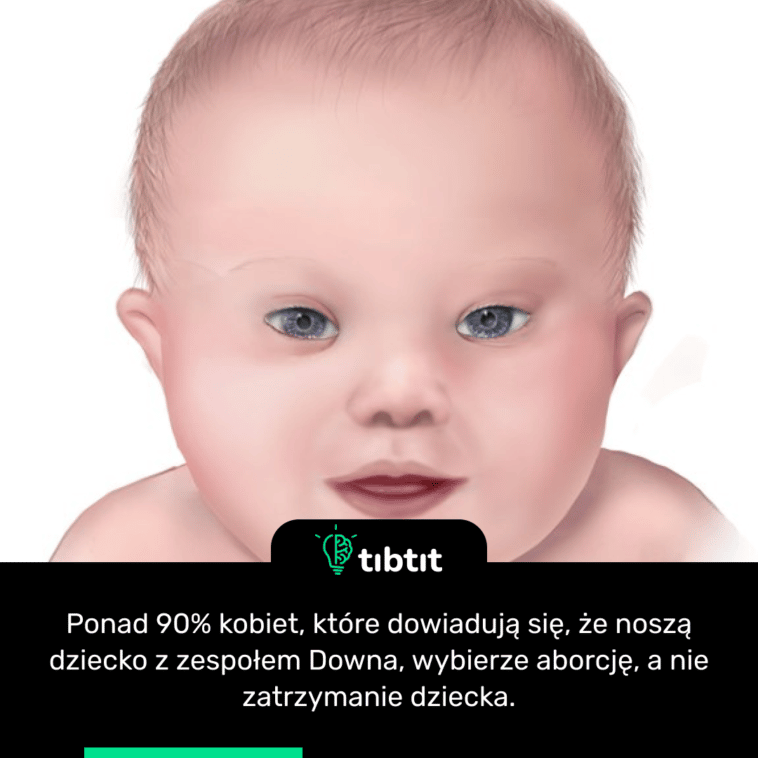 Ponad 90% kobiet, które dowiadują się, że noszą dziecko z zespołem Downa, wybierze aborcję, a nie zatrzymanie dziecka.