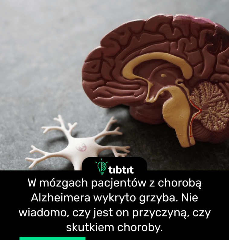 W mózgach pacjentów z chorobą Alzheimera wykryto grzyba. Nie wiadomo, czy jest on przyczyną, czy skutkiem choroby.