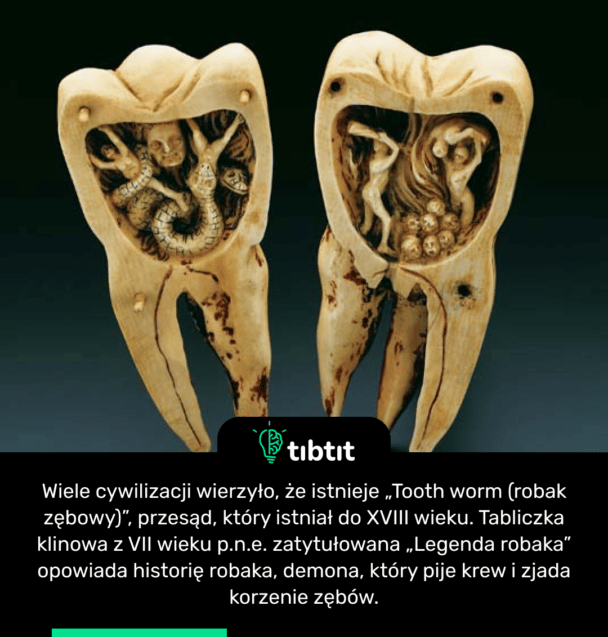 Wiele cywilizacji wierzyło, że istnieje „Tooth worm (robak zębowy)”, przesąd, który istniał do XVIII wieku. Tabliczka klinowa z VII wieku p.n.e. zatytułowana „Legenda robaka” opowiada historię robaka, demona, który pije krew i zjada korzenie zębów.