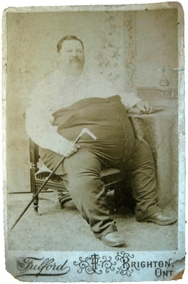 Najgrubszy człowiek świata, Leonard W. Whitton w 1880 roku.
