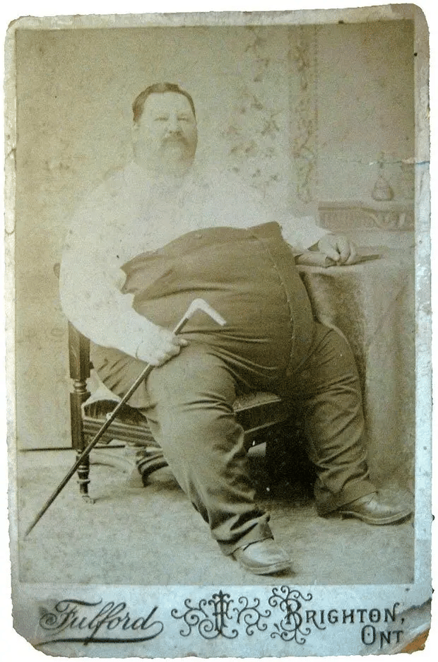 Najgrubszy człowiek świata, Leonard W. Whitton w 1880 roku.
