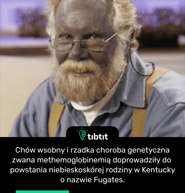Chów wsobny i rzadka choroba genetyczna zwana methemoglobinemią doprowadziły do ​​powstania niebieskoskórej rodziny w Kentucky o nazwie Fugates.