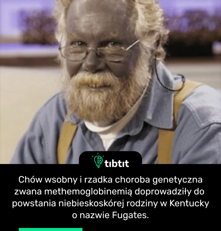 Chów wsobny i rzadka choroba genetyczna zwana methemoglobinemią doprowadziły do powstania niebieskoskórej rodziny w Kentucky o nazwie Fugates.
