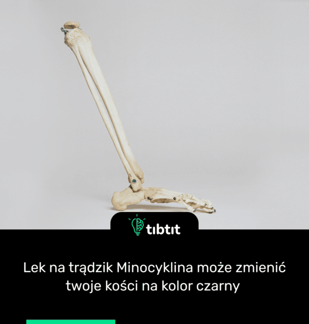 Lek na trądzik Minocyklina może zmienić twoje kości na kolor czarny