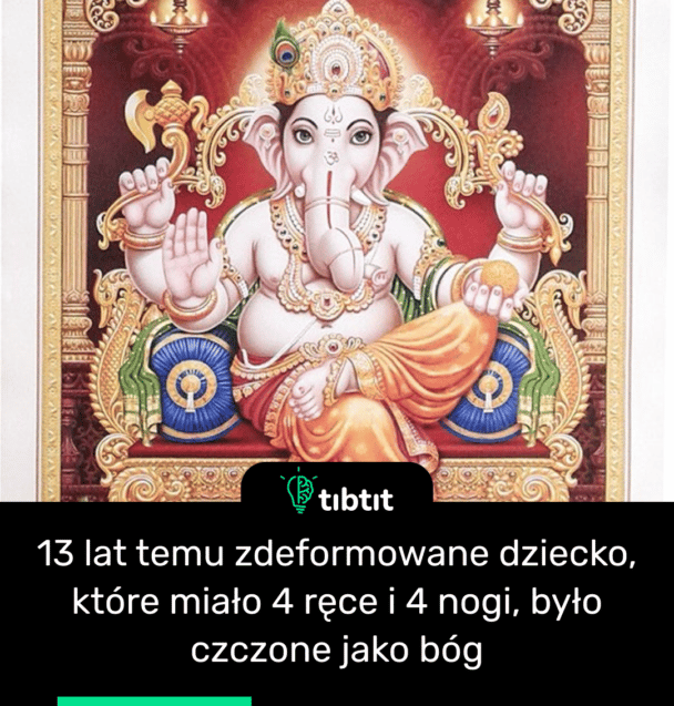13 lat temu zdeformowane dziecko, które miało 4 ręce i 4 nogi, było czczone jako bóg