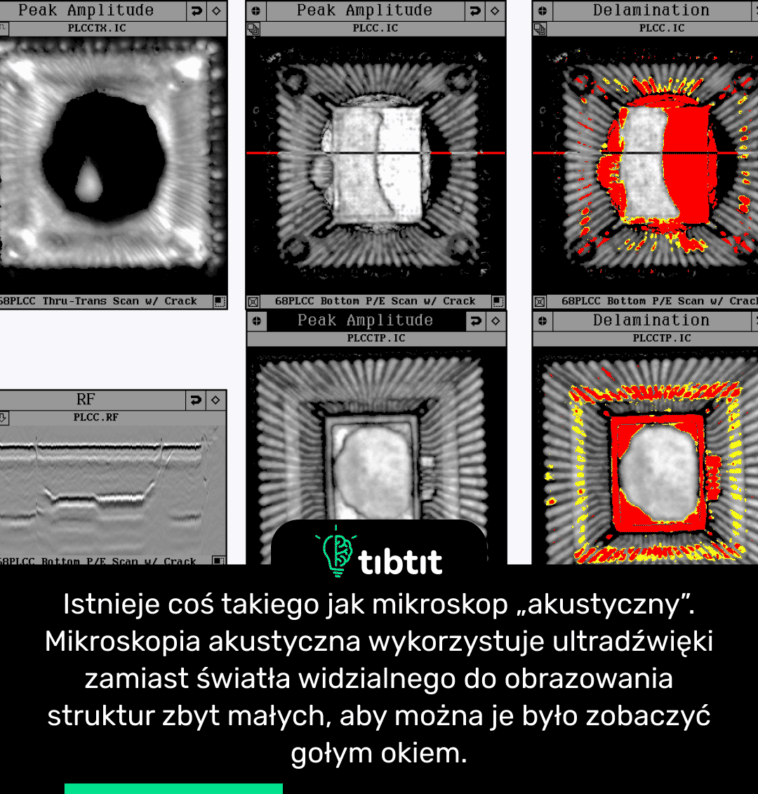 Istnieje coś takiego jak mikroskop „akustyczny”. Mikroskopia akustyczna wykorzystuje ultradźwięki zamiast światła widzialnego do obrazowania struktur zbyt małych, aby można je było zobaczyć gołym okiem.
