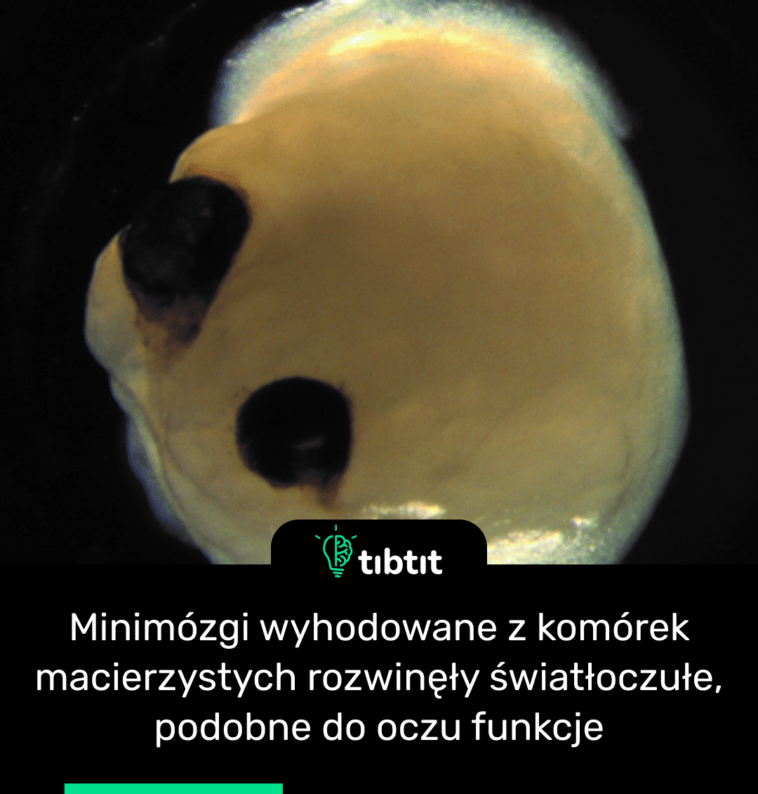 Minimózgi wyhodowane z komórek macierzystych rozwinęły światłoczułe, podobne do oczu funkcje