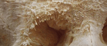 Tak wygląda rak kości