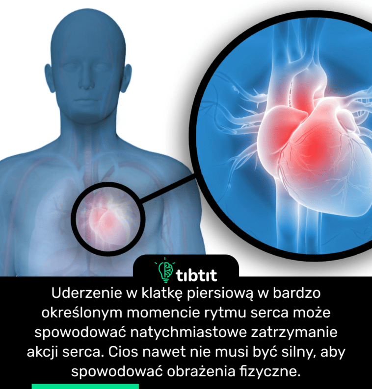 Uderzenie w klatkę piersiową w bardzo określonym momencie rytmu serca może spowodować natychmiastowe zatrzymanie akcji serca. Cios nawet nie musi być silny, aby spowodować obrażenia fizyczne.