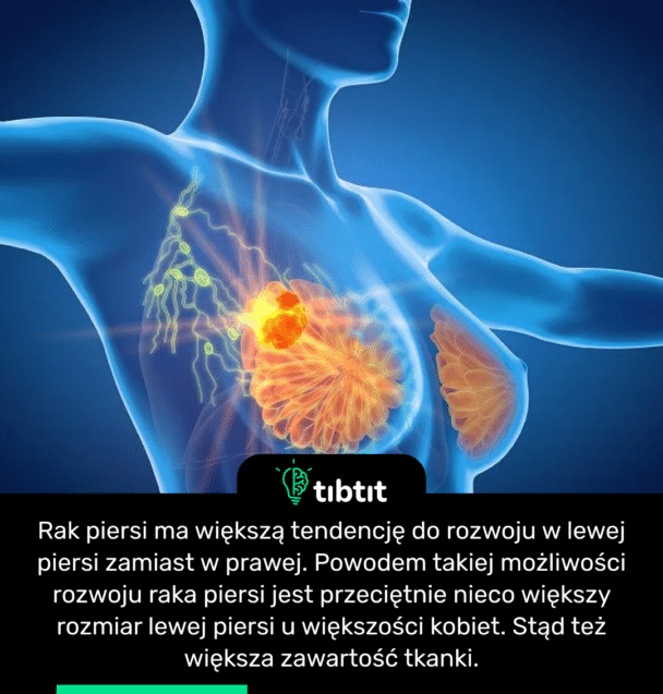 Rak piersi ma większą tendencję do rozwoju w lewej piersi zamiast w prawej. Powodem takiej możliwości rozwoju raka piersi jest przeciętnie nieco większy rozmiar lewej piersi u większości kobiet. Stąd też większa zawartość tkanki.