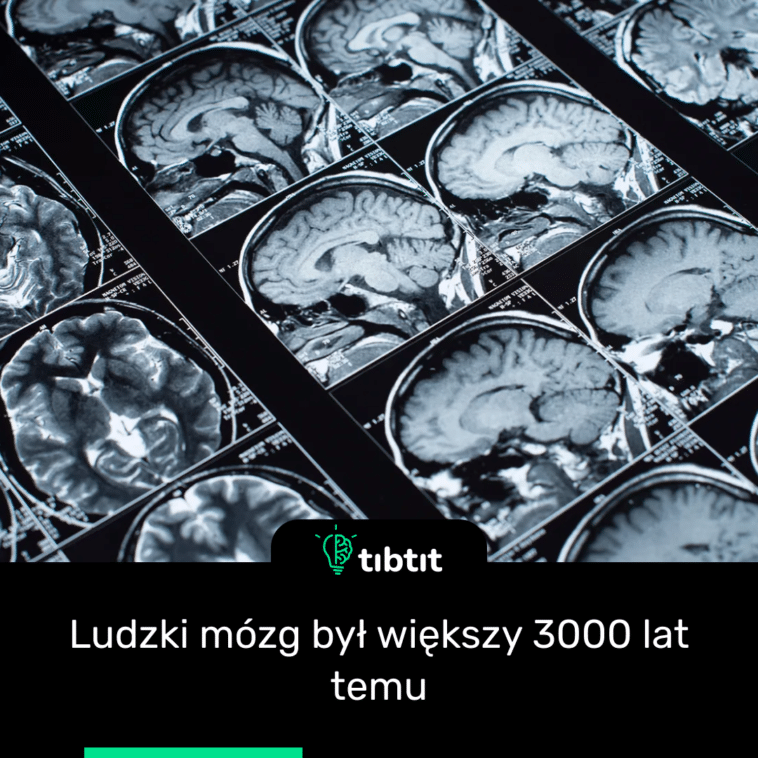 Ludzki mózg był większy 3000 lat temu