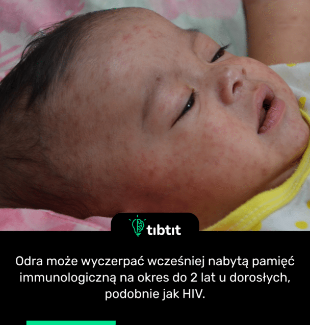 Odra może wyczerpać wcześniej nabytą pamięć immunologiczną na okres do 2 lat u dorosłych, podobnie jak HIV.