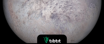 Jeden księżyc orbituje wokół Neptuna w ruchu wstecznym. Tryton orbituje Neptuna w retrogradacji, co jest jedynym dużym księżycem spośród wszystkich planet w układzie słonecznym, który to robi. Nikt tak naprawdę nie wie dlaczego