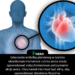 Uderzenie w klatkę piersiową w bardzo określonym momencie rytmu serca może spowodować natychmiastowe zatrzymanie akcji serca. Cios nawet nie musi być silny, aby spowodować obrażenia fizyczne.